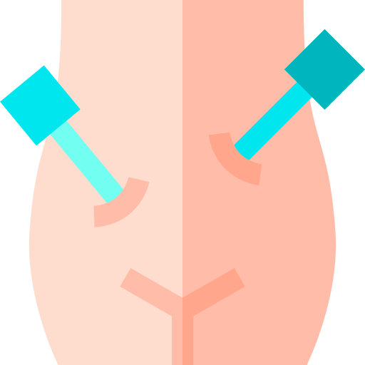 General Gynecology